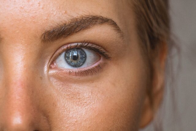 Blepharoplasty Macleod trail plastic surgery